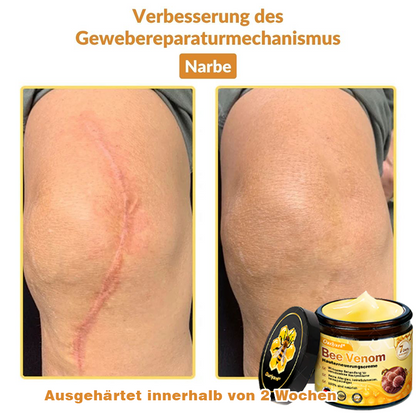 ✨✨Ourlyard® Bee Venom Skin Restoration Cream - 🔥Limited Time 80% OFF🔥