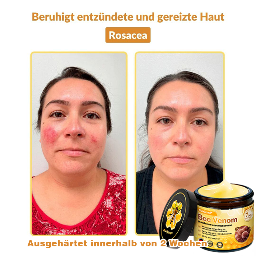 ✨✨Ourlyard® Bee Venom Skin Restoration Cream - 🔥Limited Time 80% OFF🔥