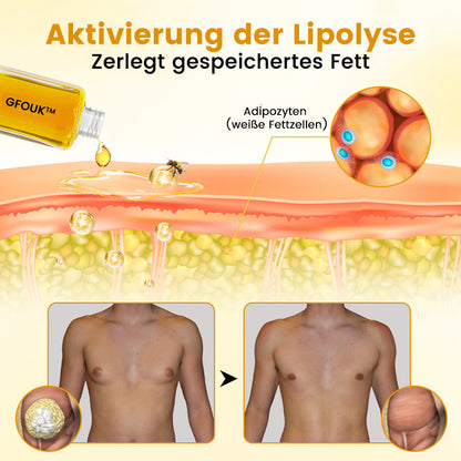 🔥GFOUK™ ThermoFirm Bienengift Öl zur Behandlung von Gynäkomastie